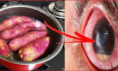 Como a batata doce pode promover a saúde dos seus olhos; Clique aqui